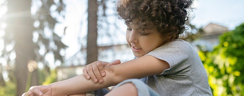 A pitada de abelha nas crianças: O tempo desempenha um papel crucial